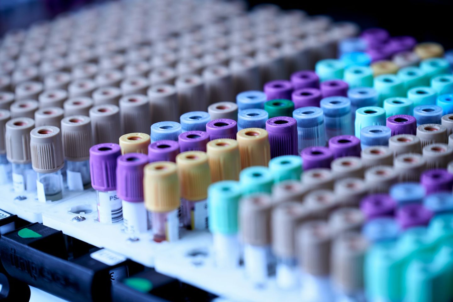 Filas de tubos de extracción de sangre con tapones de colores, en una gradilla de laboratorio
