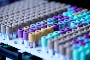 Filas de tubos de extracción de sangre con tapones de colores, en una gradilla de laboratorio